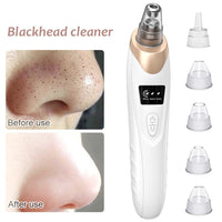 Nasal pore acne removal device
